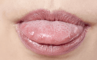 How to check health through the tongue | GOLELY