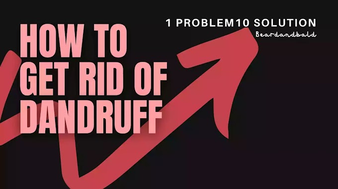 HOW TO GET RID OF DANDRUFF | 10 SOLUTION