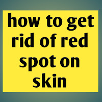 how to get rid of red spot on skin