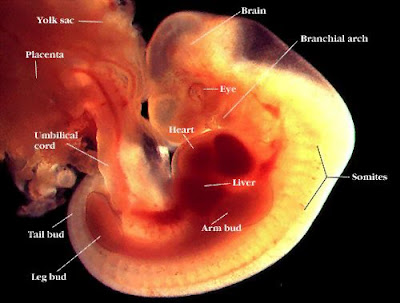 fetus at 6 weeks. fetus at 6 weeks.