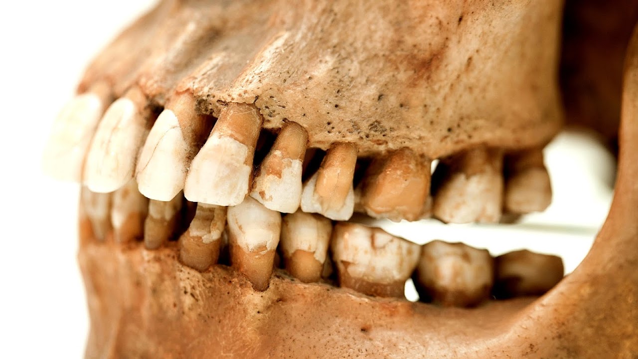 How Do I Stop Grinding My Teeth In My Sleep