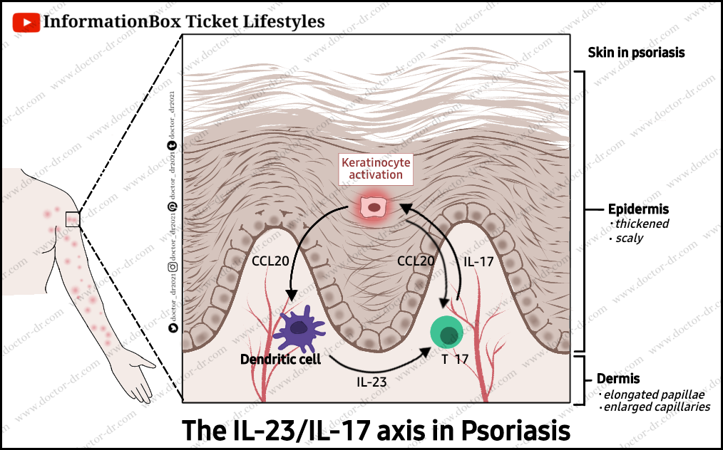 The MHC Molecule And Autoimmunity - Examples And Diagrams by Doctor-Dr