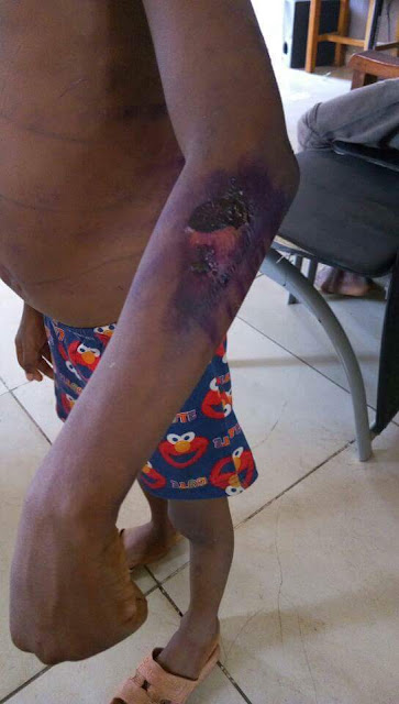 Photos: Man arrested in Abuja for burning 7-year-old son with hot pressing iron over food