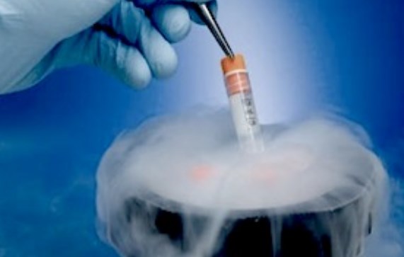 http://cryobanks-stem-cell-banking.yolasite.com/