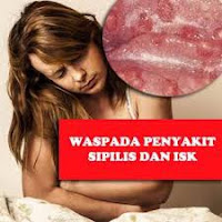 Obat Menyembuhkan Sipilis Sudah Menahun