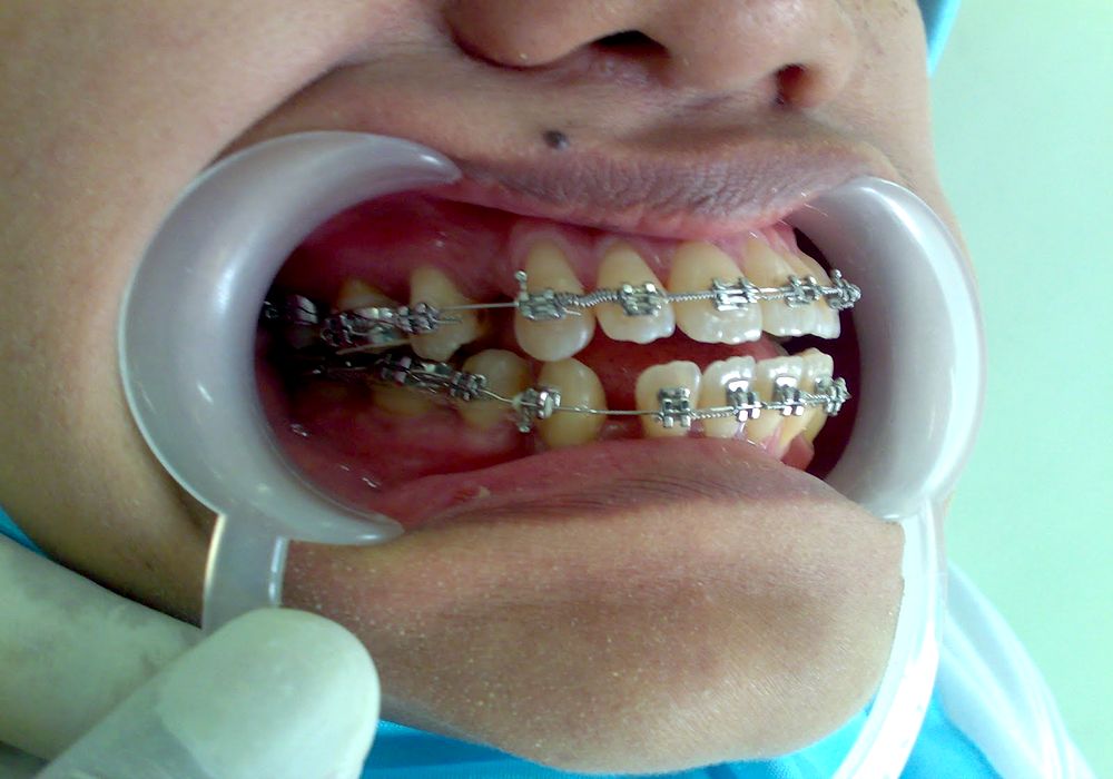 Orthodontics