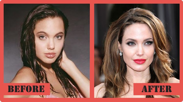 Angelina Jolie Celebrity Plastic Surgery 