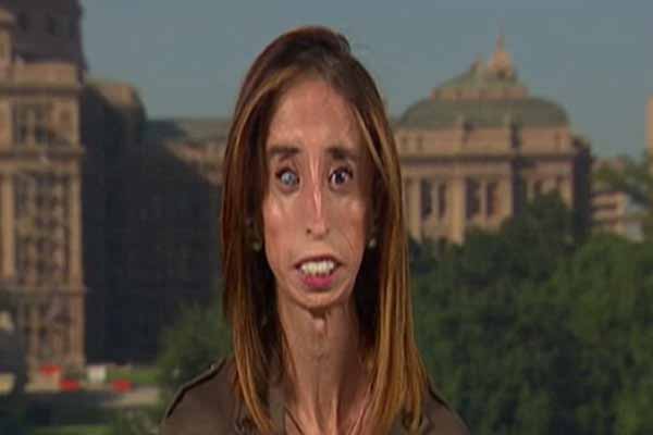 Lizzie Velasquez