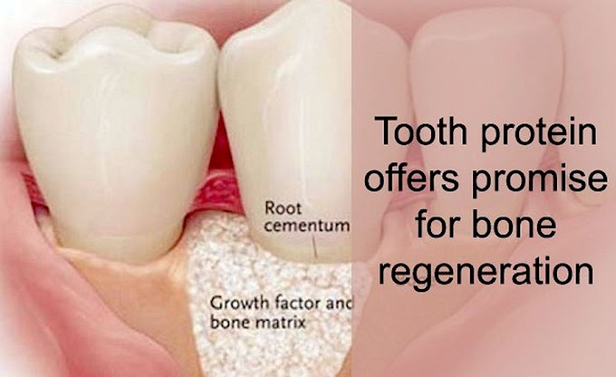 DENTAL NEWS: Tooth protein offers promise for bone regeneration