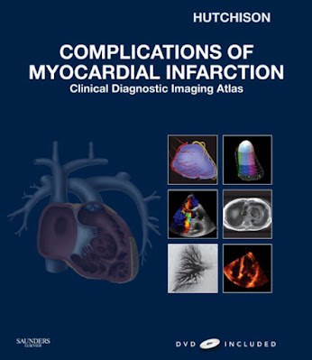 Complications of Myocardial Infarction: Clinical Diagnostic Imaging Atlas with DVD