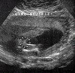 BOY OR GIRL? YOU DECIDE!