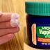 10  surprising uses of Vicks Vaporub