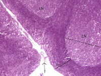 tonsil histology