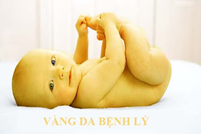 vang-da-benh-ly