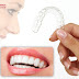 Quy trình niềng răng không mắc cài 3D Clear