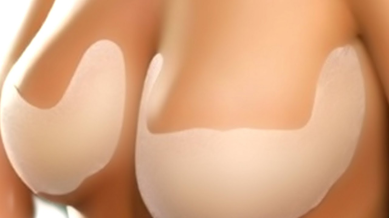 Mastopexy - Breast Lift Up