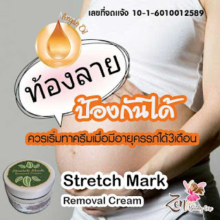 ครีมป้องกันรอยแตกลาย สำหรับคุณแม่ตั้งครรภ์ Stretch Mark Removal Cream