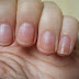 Nails say about your health? Extremely useful information