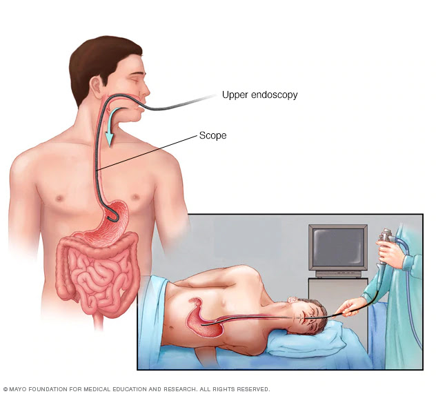 Risk factors And The Treatment Option for Gastritis