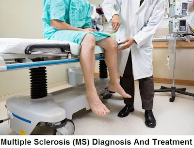 Multiple Sclerosis (MS Disease): Signs And Symptoms, Diagnosis And Treatment