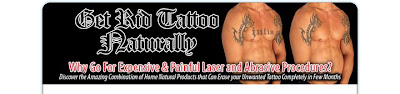 Get Rid Tattoo 