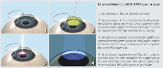 LASIK XTRA