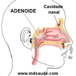 Localização das adenoides