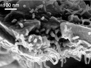 Caption: Professor Nikhil Koratkar has developed a new method to use carbon nanotubes for both detecting and repairing tiny cracks in nearly any polymer structure. In this image, carbon nanotubes are randomly dispersed in an epoxy resin, which can be molded into different structures. By infusing the polymer with electrically conductive carbon nanotubes and monitoring the electrical resistance at different points in the structure, he can pinpoint the location and length of even the tiniest stress-induced crack. Once a crack is located, Kotakar can then send a short electrical charge to the area in order to heat up the carbon nanotubes and in turn melt an embedded healing agent that will flow into and seal the crack. Credit: Rensselaer/ N. Koratkar. Usage Restrictions: Please include photo credit