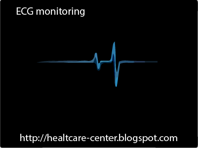 ECG monitoring