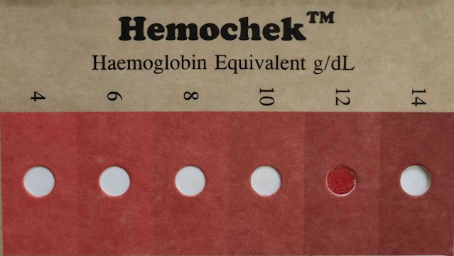 Hemochek