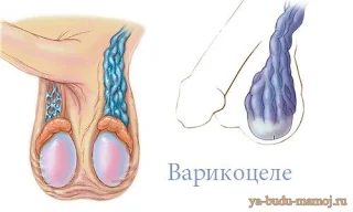 проблема в болезни