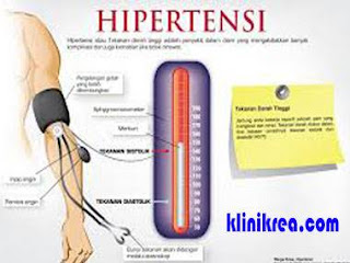 Penyebab Dan Cara Mengatasi Darah Tinggi Atau Hipertensi