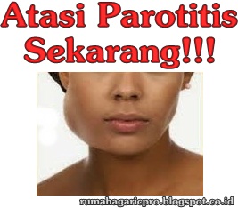 Obat Parotitis