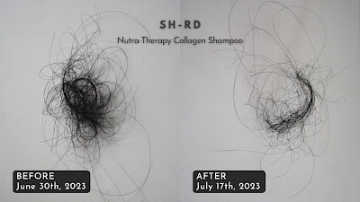 Before-After-SH-RD-nutra-therapy-shampoo-bintangmahayana-com