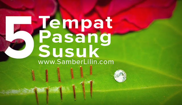 tempat pasang susuk