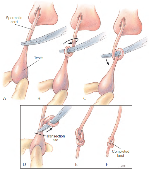 castration-dog-cat-castração-gato-tecnica-cirurgica