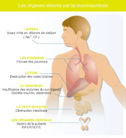 Ensemble contre la mucoviscidose