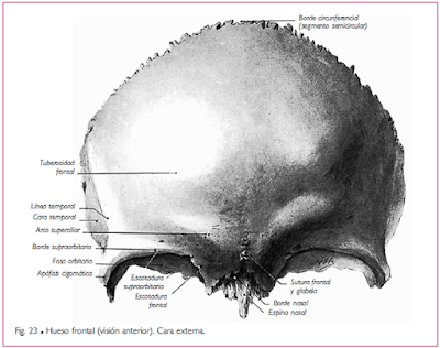 Hueso Frontal vista anterior, se puede apreciar las gibas frontales laterales, los arcos superciliares así como la giba frontal media o glabela