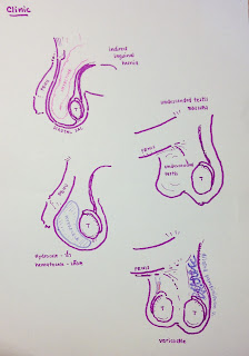   hernia คือ, โรคไส้เลื่อนในผู้หญิง, ไส้เลื่อน อาการ วิธี-รักษา, ไส้เลื่อนลงอัณฑะ อาการ, สมุนไพรรักษาโรคไส้เลื่อน, วิธี รักษา โรค ไส้เลื่อน, ไส้เลื่อน ภาษาอังกฤษ, โรคไส้เลื่อน ภาษาอังกฤษ, ไส้เลื่อนสะดือ ผู้ใหญ่