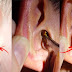 OMG!! Biggest Disgusting Earwax Removed From A Human Ear! Shocking!