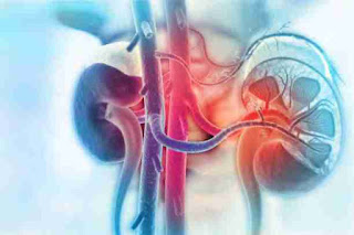 কিডনি ড্যামেজের লক্ষণ - Symptoms Of Kidney Disease Bengali  About Bangla কিডনি সমস্যা, কিডনি ইনফেকশনের লক্ষণ, কিডনি রোগের লক্ষণ, কিডনি নষ্ট হওয়ার লক্ষণ,কিডনি ইনফেকশনের লক্ষণ, aboutbangla.com