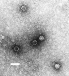 Poliovírus detectados a partir de amostras ambientais em Israel - atualização