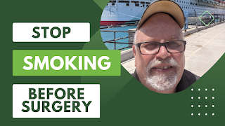 Blog post - should you stop smoking before surgery?