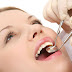 Phương pháp lấy cao răng hàng đầu