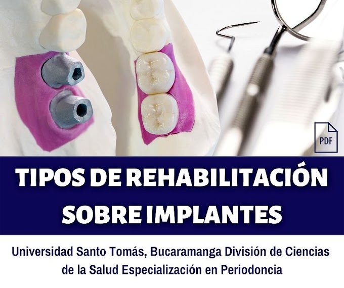 PDF: Tipos de rehabilitación sobre implantes