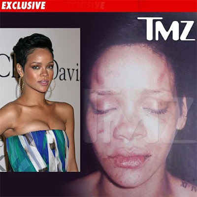 rihanna pictures after beating. Labels: rihanna picture after