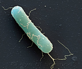 Bakteri Clostridium botulinum