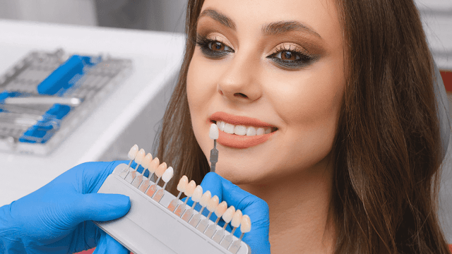 veneers-for-whiter-teeth-barbies-beauty-bits