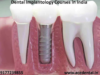 Dental Courses in India, General Dentistry Courses, Diploma Courses After BDS, Rotary Endodontics Course, Endodontic Certificate Course, Dental Implant Courses in India