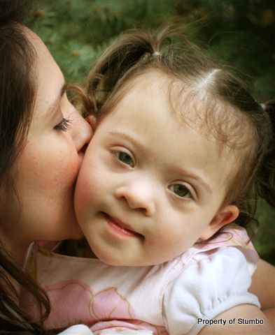 treatments for down syndrome. I see Down syndrome every day,